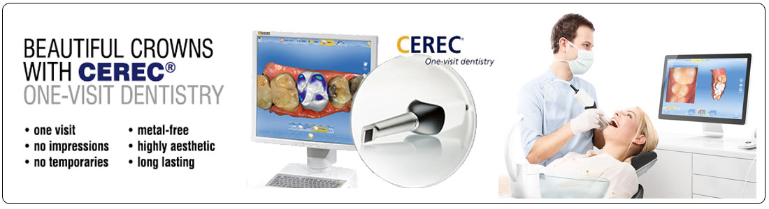 Beautiful crowns with CEREC® one-visit dentistry: one visit, no impressions, no temporaries, metal-free, highly aesthetic, long lasting
